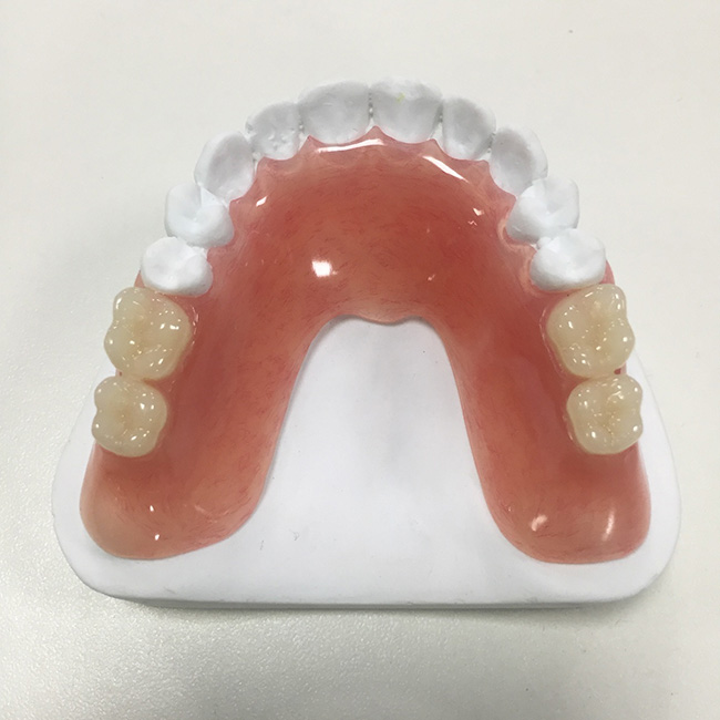 Partial dentures
