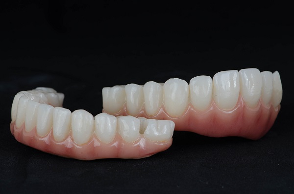 Hybrid Implant Dental Solutions