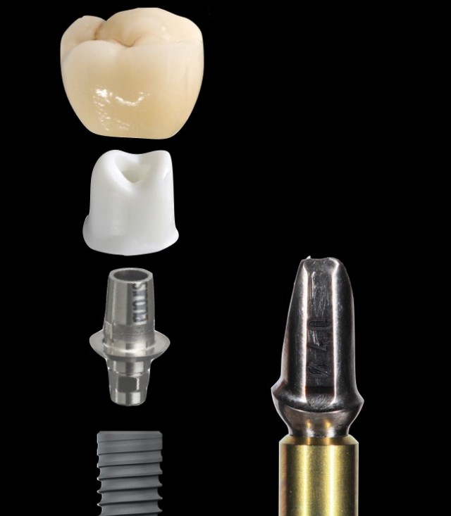 zirconia abutments.jpg