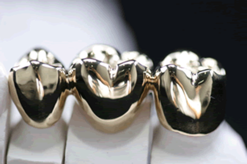 full cast crowns