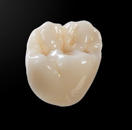 full zirconia crown