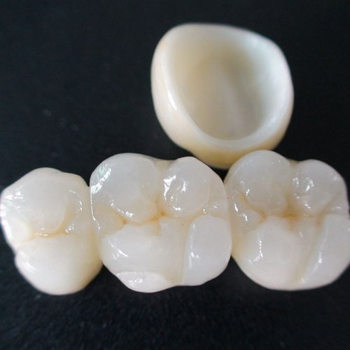 full zirconia crown
