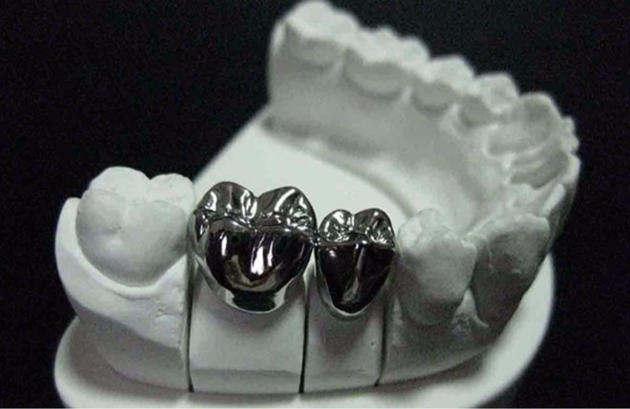 full cast crowns