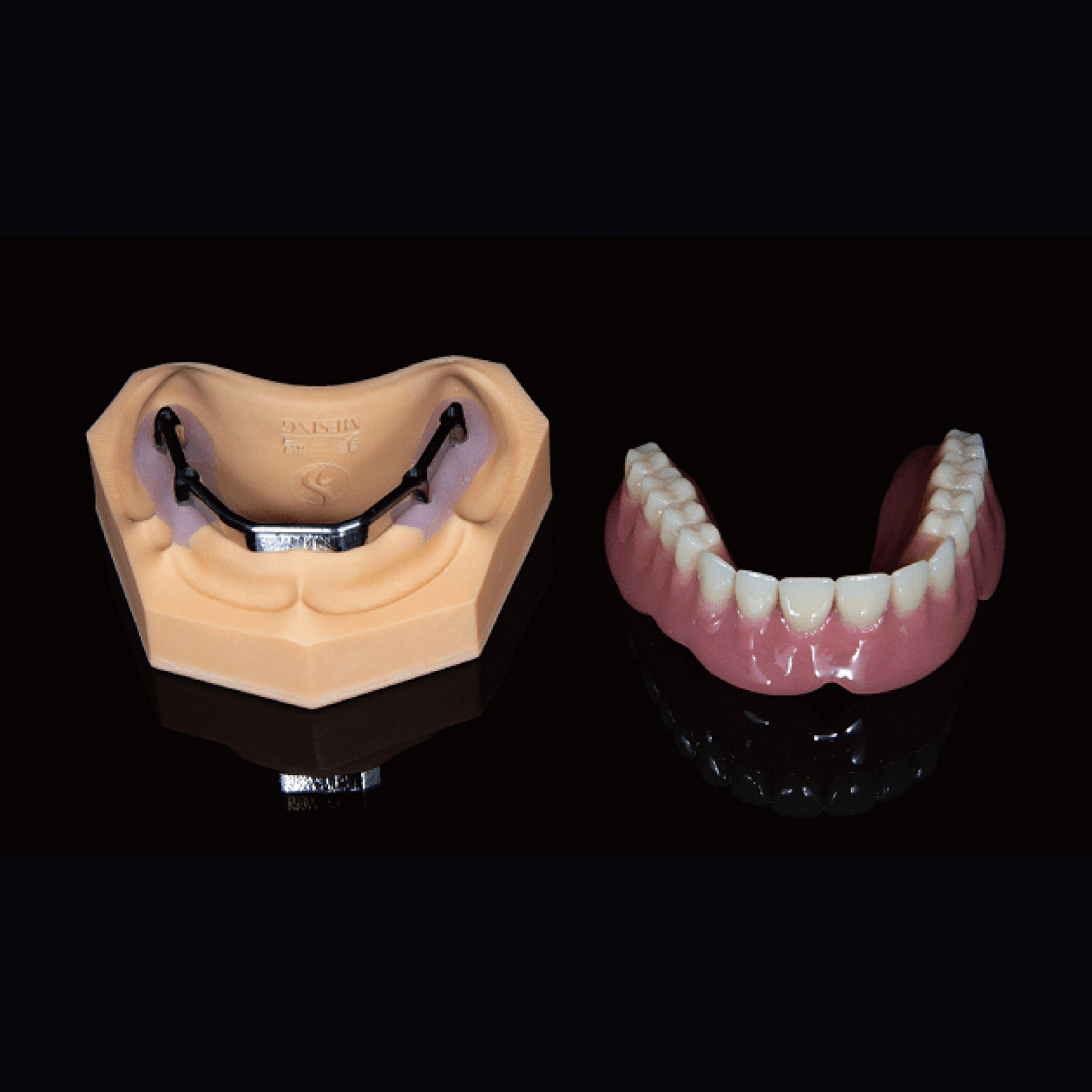 Custom Dental Implant