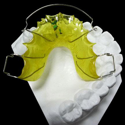 Modern Dental Alignment Tools