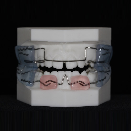 The Power of Digital Orthodontics