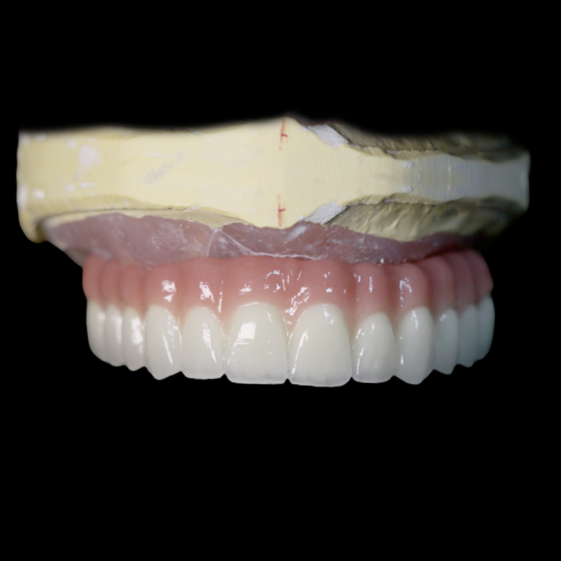 A Comprehensive Guide to Understanding Dental Implants and Their Function