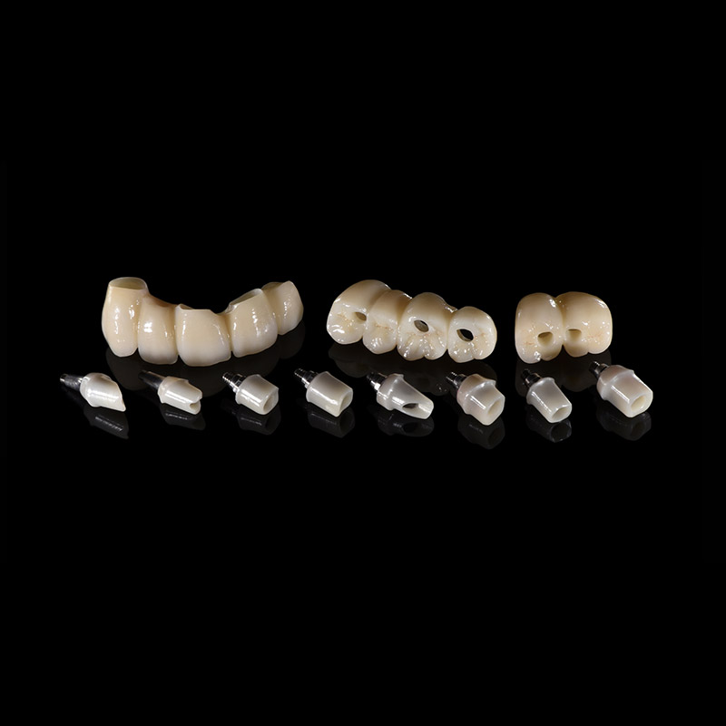 Dental Implant Recovery: Understanding the Timeframe and Considerations